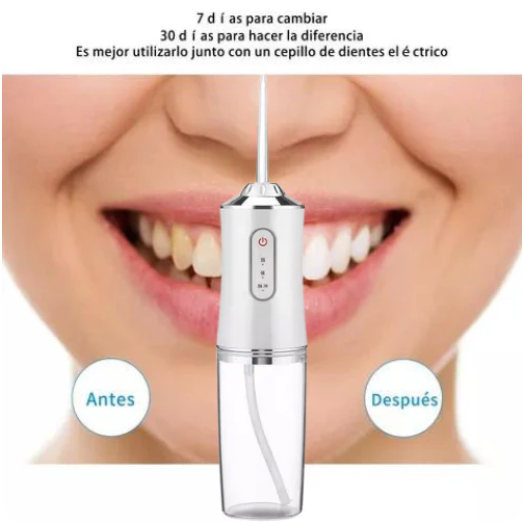 Sonrisa Pro - Irrigador Dental para Limpieza Profunda