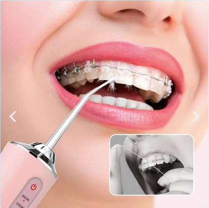 Sonrisa Pro - Irrigador Dental para Limpieza Profunda